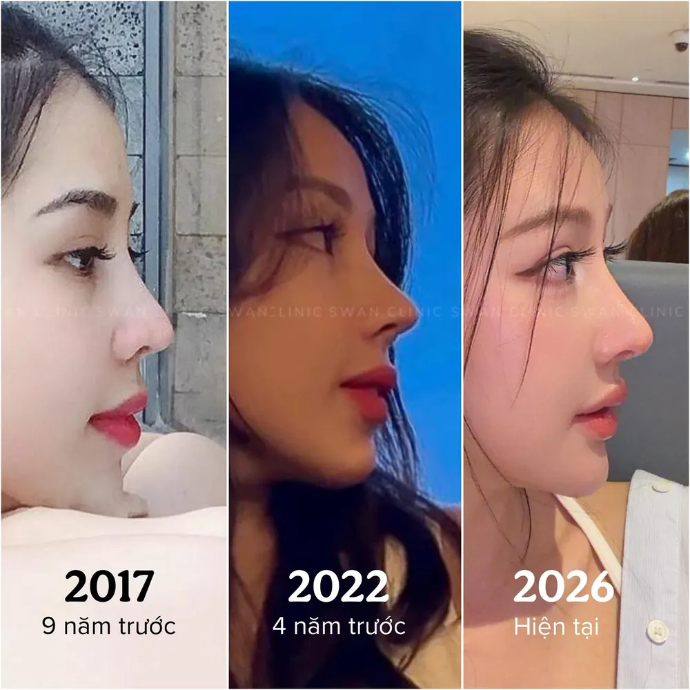 Cùng một gương mặt qua 2017, 2022, 2026