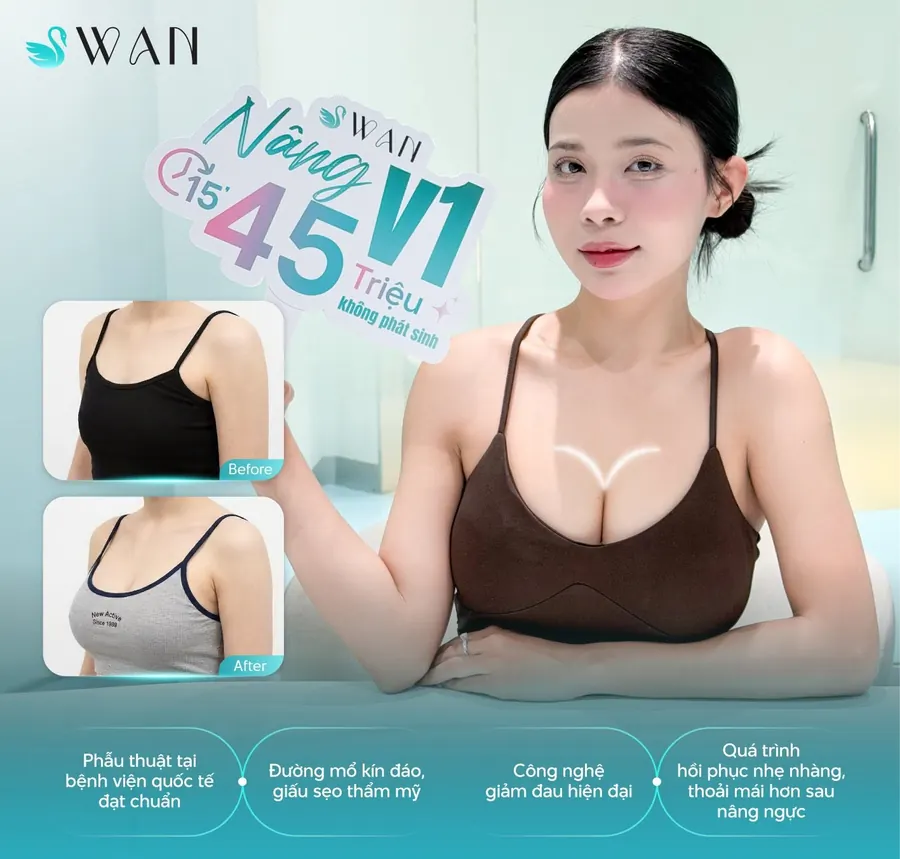 Nâng ngực V1 trước và sau